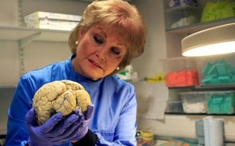 Angela Rippon in the BBC  documentary 'The Truth About Dementia'  Credit: BBC