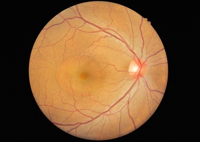 Study focused on the retina. Credit: Anukool Manaton/ Shutterstock