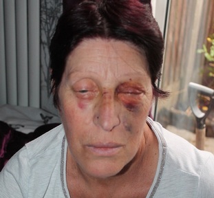 Joy Watson. Credit: Alzheimer’s Society