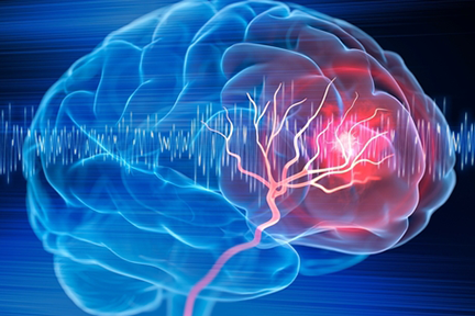 Thinking caps that electrically stimulate the brain could boost memory of people with dementia